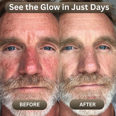 Organic Beef Tallow Balm with Raw Honey for Men - JumpingDots