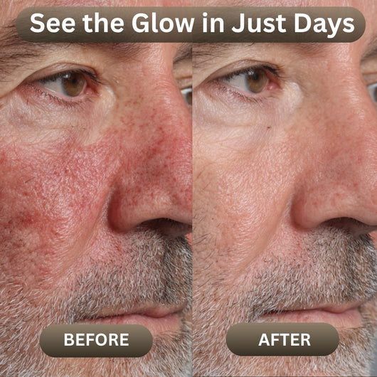 Organic Beef Tallow Balm with Raw Honey for Men - JumpingDots