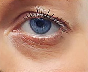 Tired Eyes Tell the Story