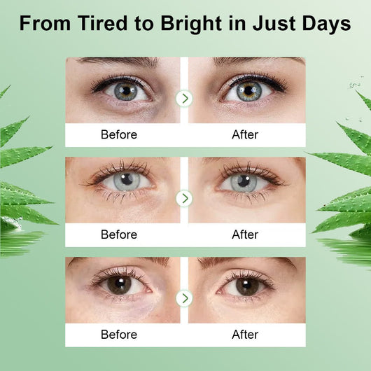 Collagen & Aloe Vera Eye Mask - JumpingDots