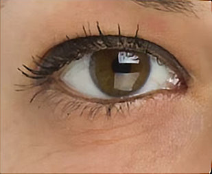 Wrinkles That Steal Your Glow